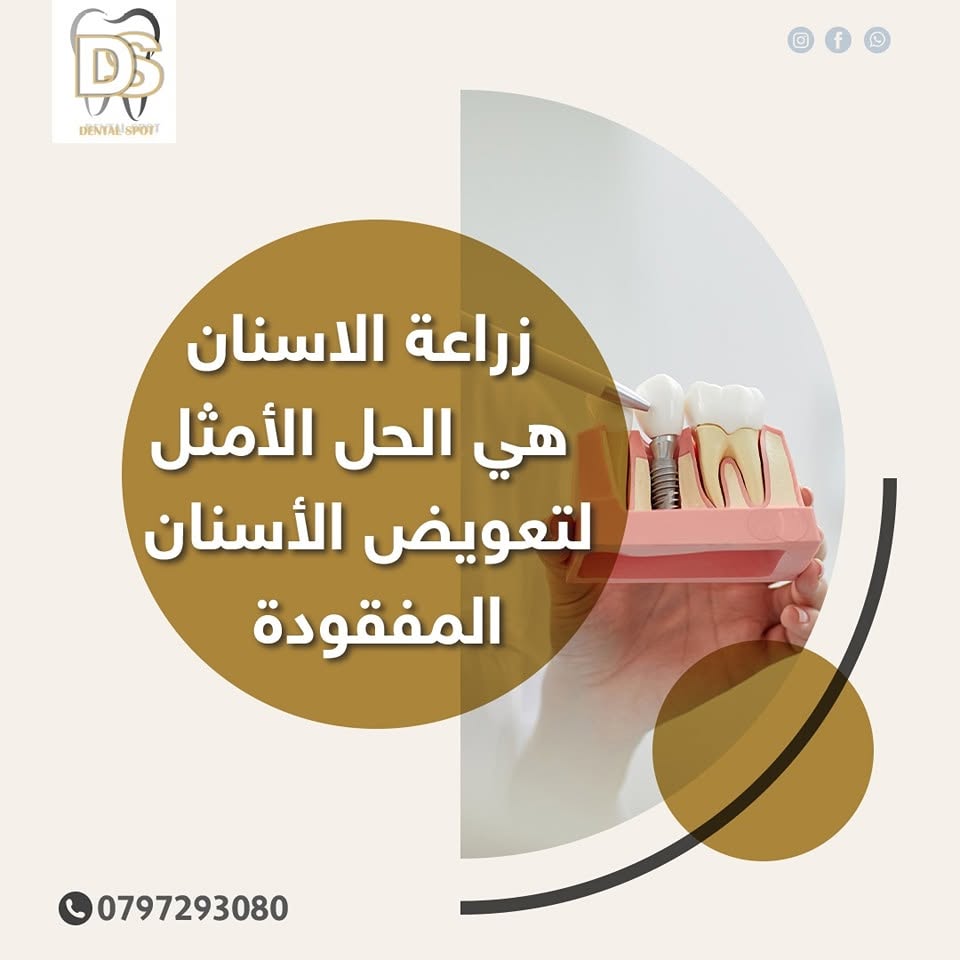 تلبيسات الأسنان لحماية السن الضعيف أو المتكسر
