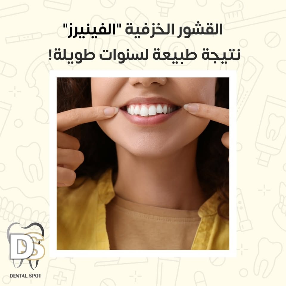 علاج وتجميل اللثة في عيادة أسنان بدابوق