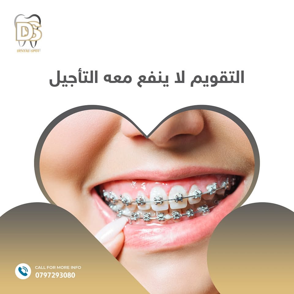 تقويم الأسنان للأطفال والبالغين في دابوق